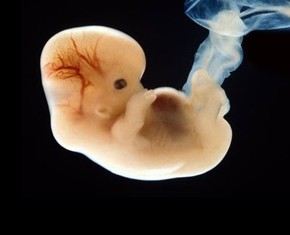 Is the Human Soul a Product of Evolution?