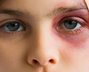 Never Hit a Child
