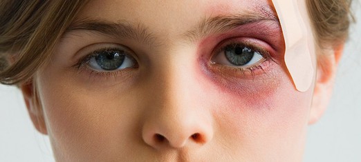 Never Hit a Child