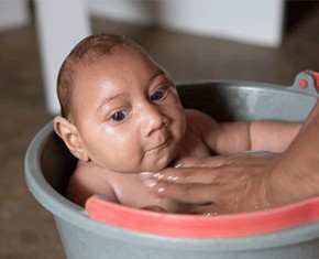 The Zika Virus, Public Health and One World
